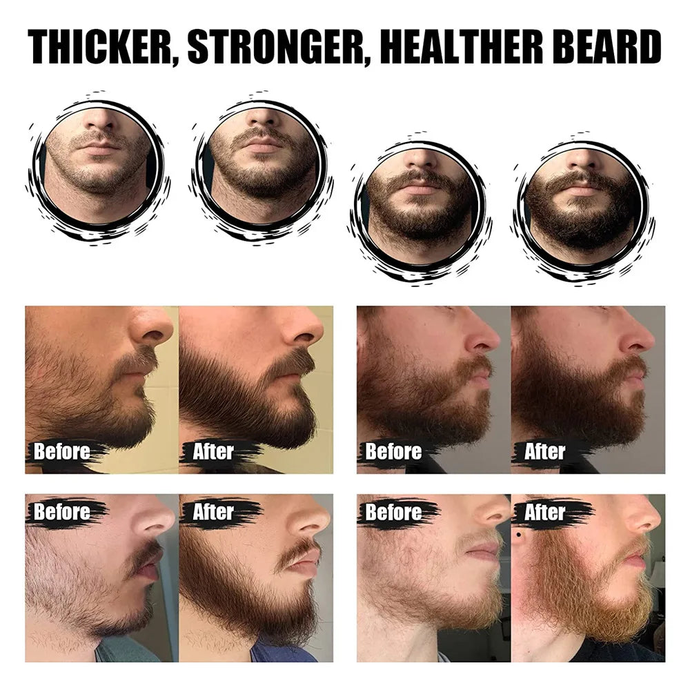 Beard Hair Enhancer Growth Thickening 
Kit